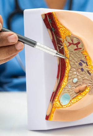 Breast Surgery in Dubai