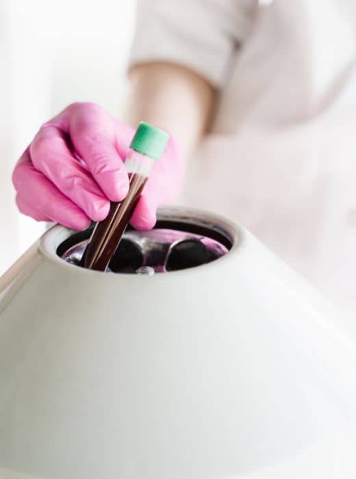 Ideal Candidates for PRP Face & Hair