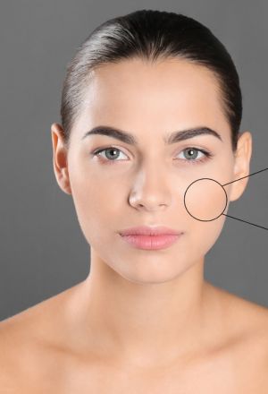 Sensitive Areas Whitening Dubai