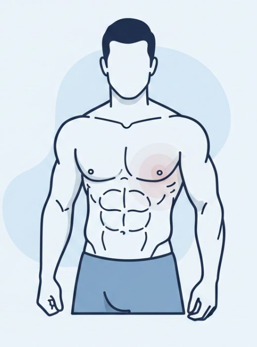 Who is an Ideal Candidate for Gynecomastia