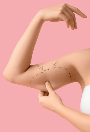 arm Lifting