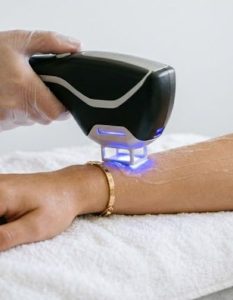 Laser Hair Removal